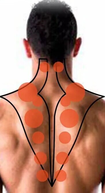 TrapezEase - Trapezius Trigger Point Massage Tool